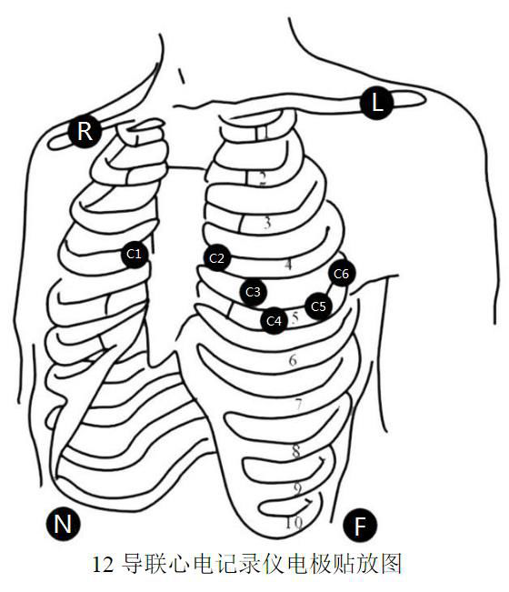 心电图电极的位置图片